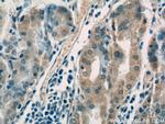 IGFBP1 Antibody in Immunohistochemistry (Paraffin) (IHC (P))