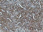 ACSL1 Antibody in Immunohistochemistry (Paraffin) (IHC (P))