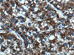 ACSL1 Antibody in Immunohistochemistry (Paraffin) (IHC (P))