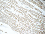 ACSL1 Antibody in Immunohistochemistry (Paraffin) (IHC (P))