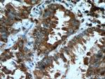 ACSL1 Antibody in Immunohistochemistry (Paraffin) (IHC (P))