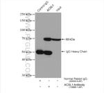 ACSL1 Antibody in Immunoprecipitation (IP)