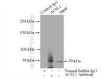 ACSL1 Antibody in Immunoprecipitation (IP)