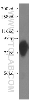 ACSL1 Antibody in Western Blot (WB)