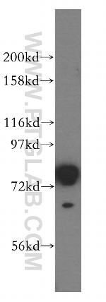 ACSL1 Antibody in Western Blot (WB)