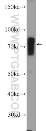 ACSL1 Antibody in Western Blot (WB)