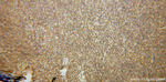 GRK2 Antibody in Immunohistochemistry (Paraffin) (IHC (P))