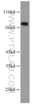 GRK2 Antibody in Western Blot (WB)