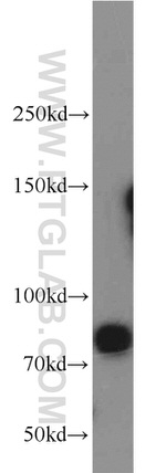 GRK2 Antibody in Western Blot (WB)