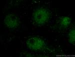 Cryptochrome 2 Antibody in Immunocytochemistry (ICC/IF)