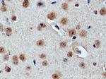 Cryptochrome 2 Antibody in Immunohistochemistry (Paraffin) (IHC (P))