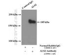 ALS2 Antibody in Immunoprecipitation (IP)