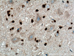 OLIG2 Antibody in Immunohistochemistry (Paraffin) (IHC (P))