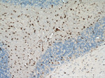 OLIG2 Antibody in Immunohistochemistry (Paraffin) (IHC (P))