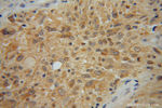 OLIG2 Antibody in Immunohistochemistry (Paraffin) (IHC (P))