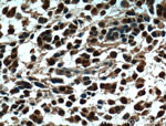 OLIG2 Antibody in Immunohistochemistry (Paraffin) (IHC (P))