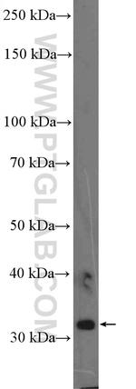 OLIG2 Antibody in Western Blot (WB)