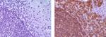 CD19 Antibody in Immunohistochemistry (Paraffin) (IHC (P))