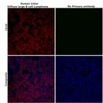 CD20 Antibody in Immunohistochemistry (Paraffin) (IHC (P))