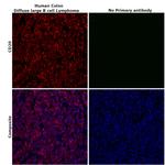 CD20 Antibody in Immunohistochemistry (Paraffin) (IHC (P))