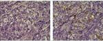 CD66e (CEA) Antibody in Immunohistochemistry (Paraffin) (IHC (P))