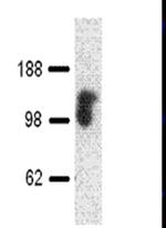 CD107a (LAMP-1) Antibody in Western Blot (WB)