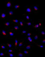 CD107a (LAMP-1) Antibody in Immunocytochemistry (ICC/IF)