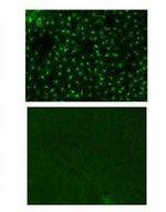 CD207 (Langerin) Antibody in Immunohistochemistry (IHC)