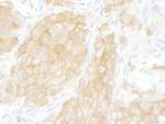 14-3-3 theta Antibody in Immunohistochemistry (IHC)