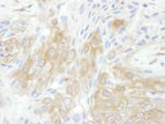 14-3-3 theta Antibody in Immunohistochemistry (IHC)