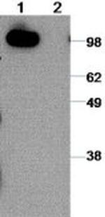 CD324 (E-Cadherin) Antibody in Western Blot (WB)