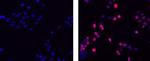 Rat IgG2a kappa Isotype Control in Immunocytochemistry (ICC/IF)