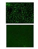 Rat IgG2a kappa Isotype Control in Immunohistochemistry (IHC)