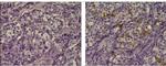 Mouse IgG1 kappa Isotype Control in Immunohistochemistry (Paraffin) (IHC (P))