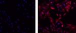 Mouse IgG2b kappa Isotype Control in Immunocytochemistry (ICC/IF)