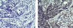 Mouse IgG2b kappa Isotype Control in Immunohistochemistry (Paraffin) (IHC (P))