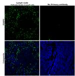 FOXP3 Antibody in Immunohistochemistry (Paraffin) (IHC (P))