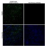 FOXP3 Antibody in Immunohistochemistry (Paraffin) (IHC (P))