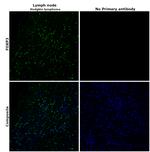 FOXP3 Antibody in Immunohistochemistry (Paraffin) (IHC (P))