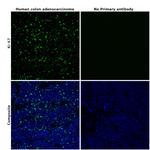 Ki-67 Antibody in Immunohistochemistry (Paraffin) (IHC (P))