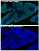 Ki-67 Antibody in Immunohistochemistry (Paraffin) (IHC (P))