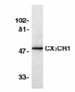 CX3CR1 Antibody in Western Blot (WB)