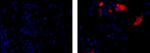 Chorionic Gonadotropin Antibody in Immunocytochemistry (ICC/IF)