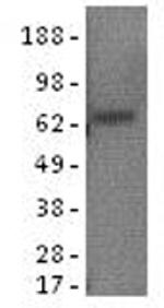 alpha-Fetoprotein Antibody in Western Blot (WB)