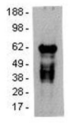 Syk Antibody in Western Blot (WB)