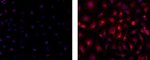 Cytokeratin 7 Antibody in Immunocytochemistry (ICC/IF)