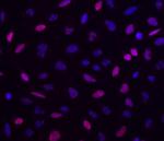 Phospho-ATM (Ser1981) Antibody in Immunocytochemistry (ICC/IF)