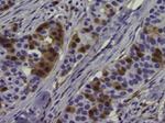 Phospho-ERK1/2 (Thr202, Tyr204) Antibody in Immunohistochemistry (Paraffin) (IHC (P))