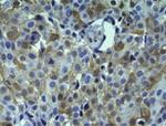 HSP27 Antibody in Immunohistochemistry (Paraffin) (IHC (P))