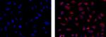 EEA1 Antibody in Immunocytochemistry (ICC/IF)